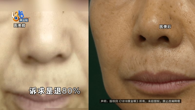  119万医美消费全景复盘：定价体系、风险边界与维权路径技术指南 新闻