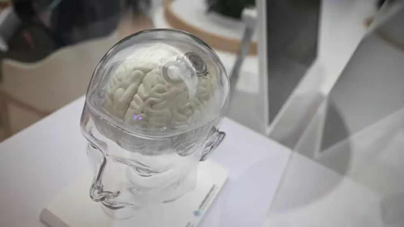  技术突破与资本热潮：脑机接口产业商业化路径深度解析 汽车科技